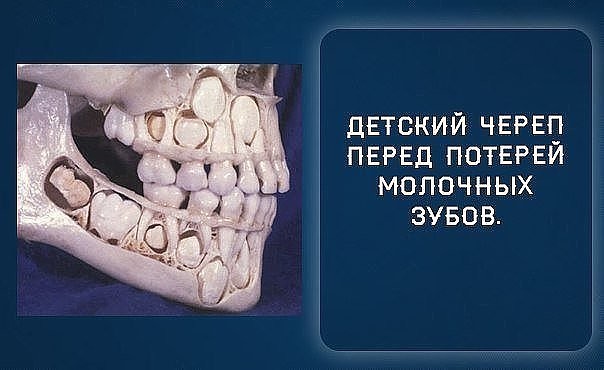 Как выглядит череп ребенка Как выглядит череп ребенка