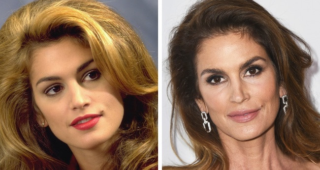 Мускульный тип старения примеры Мускульный тип старения примеры